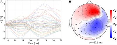 Influence of Head Tissue Conductivity Uncertainties on EEG Dipole Reconstruction